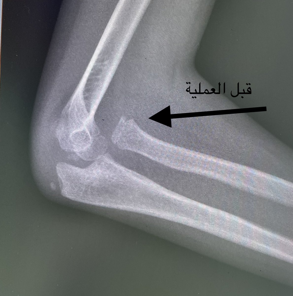 Ziad almulhim Alanazi د.زياد أحمد الملحم tweet media