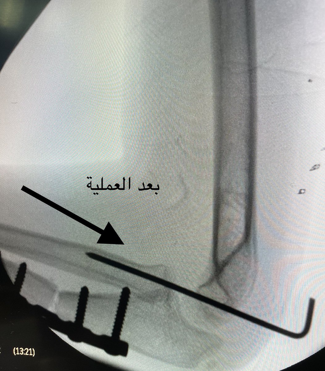 Ziad almulhim Alanazi د.زياد أحمد الملحم tweet media