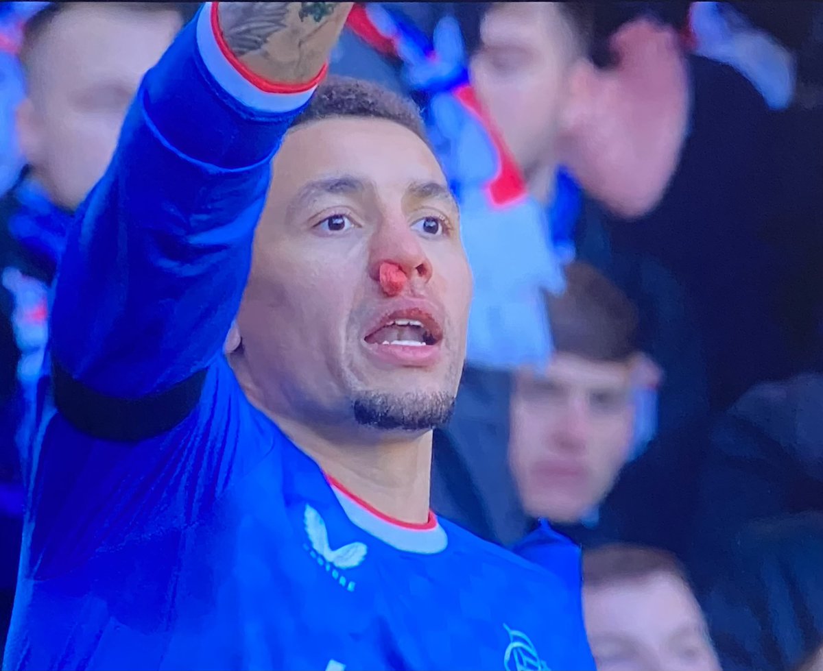 RaingersFc's tweet photo. A tampon being used in its natural position.....
#RANCEL https://t.co/Wkk6JEDrNE