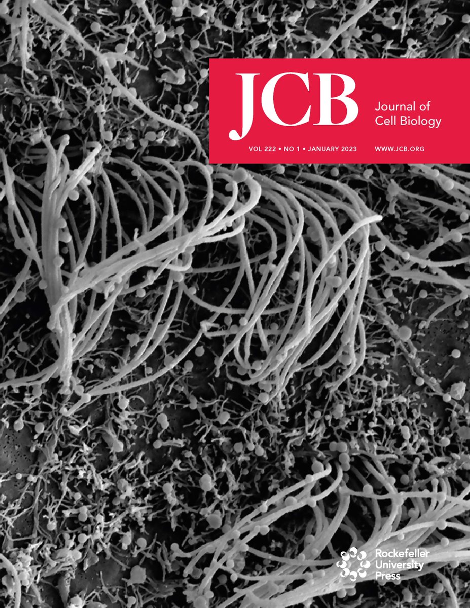 Journal of Cell Biology (@jcellbiol) on Twitter photo Our January cover shows a scanning electron microscopy micrograph of ependymal cells lining the surface of a mouse brain ventricle. From <a href="/ignatenkolesya/">Olesia Ignatenko</a> et al <a href="/ASW_lab/">Anu Suomalainen-Wartiovaara Lab</a> (bit.ly/3hKkL4D). Read JCB’s January Issue: bit.ly/3BXac5c Our January cover shows a scanning electron microscopy micrograph of ependymal cells lining the surface of a mouse brain ventricle. From <a href="/ignatenkolesya/">Olesia Ignatenko</a> et al <a href="/ASW_lab/">Anu Suomalainen-Wartiovaara Lab</a> (bit.ly/3hKkL4D). Read JCB’s January Issue: bit.ly/3BXac5c