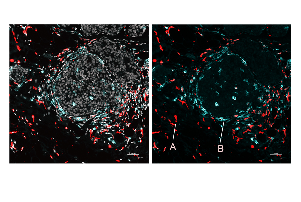WeillCornell's tweet photo. A team led by Dr. Dan Landau (@landau_lab) of @WCM_MeyerCancer uses a new method to map with sharper clarity the gene activity, protein types and locations of cells within organs and tumors.

https://t.co/X19LuLt7iw https://t.co/NcsF6wQ9hC