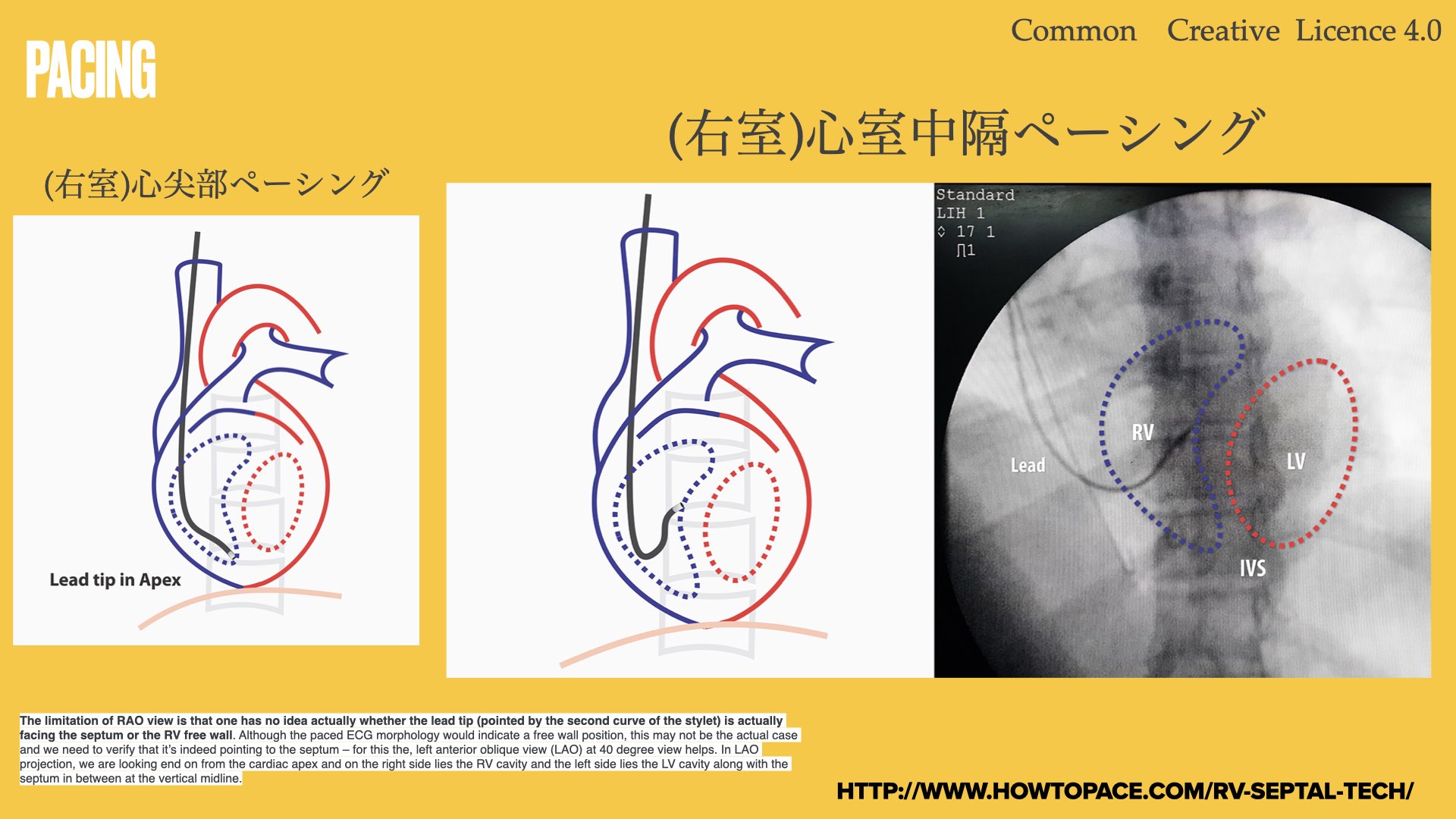 N. Tsukishima EP大学心電図検定学部試験対策科担任 on X