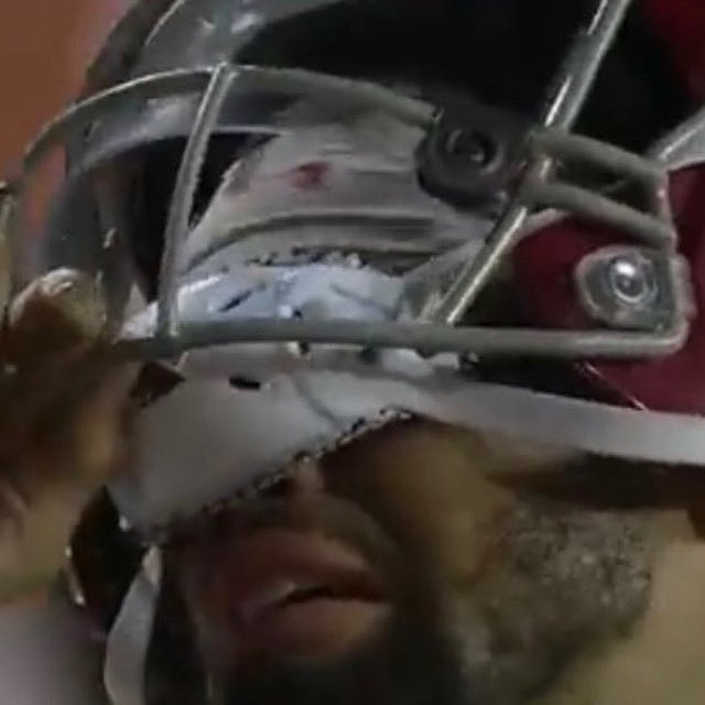 USC loses, America wins.