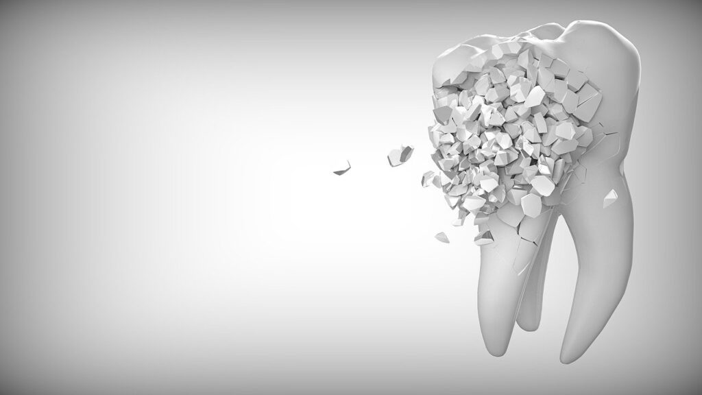 Do you have tooth pain that comes and goes when you are eating certain foods or chewing? You may have tooth sensitivity. It could also be cracked tooth syndrome which would require professional dental treatments to fix. #toothdamage 
dentistwestmichigan.com/cracked-tooth-…