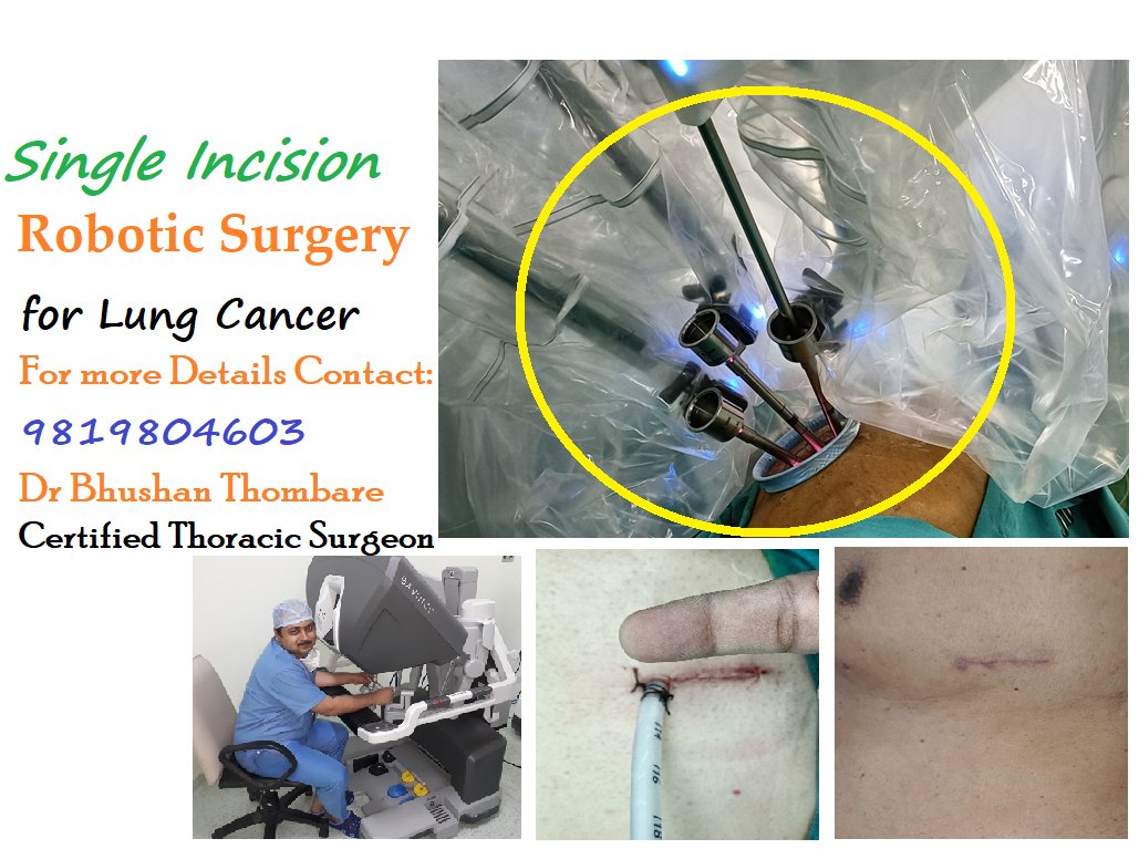 dr_thoracic's tweet photo. https://t.co/L50hg3zuXH