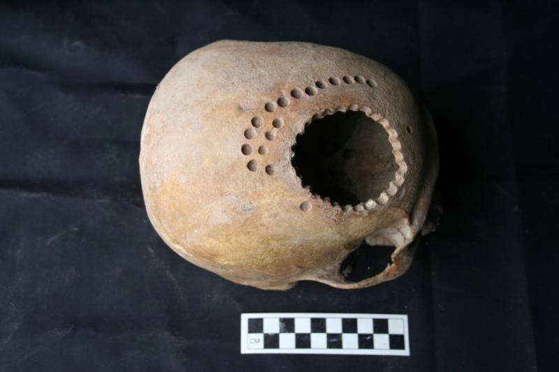 scienceshistory's tweet photo. In the Peruvian Andes, bioarchaeologist Danielle Kurin has found evidence of widespread trepanation, or cranial surgery, from A.D 1000 to 1250, a period that might have been especially violent in the region. Some skulls even show evidence of having been practiced on post-mortem https://t.co/ycK7vZuCdv
