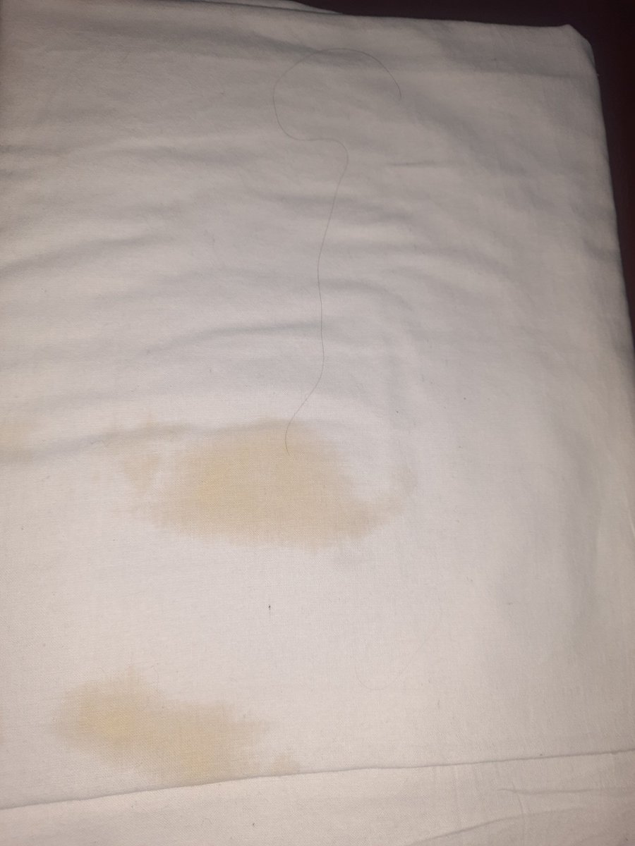 MSchanakya's tweet photo. @IRCTCofficial @irctcsouthzone we have confirmed tickets of Two Tier AC in train No. 08568 under PNR 4341606189 . We received the worst pillow &amp; blanks (attached). Those are dirty and getting bad smell Please respond and take necessary action. https://t.co/fq3S2el0ho