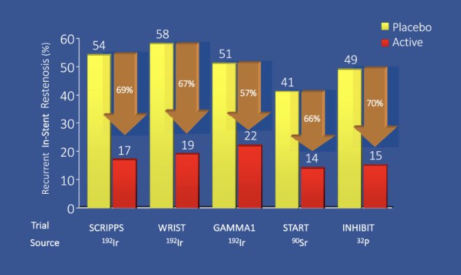 DocSavageTJU's tweet photo. #IVBT was robust for #BMS #ISR (Figure from @MyJSCAI ed.) but there are no RCT with #DES @SandeepNathanMD @AGoldsweig @sahilparikhmd @SuzanneJBaron @mirvatalasnag @MortonKern @Drroxmehran @kevinjamescroce @SrihariNaiduMD @GreggWStone @DrMarthaGulati @DrCindyGrines @ron_waksman https://t.co/xQ4042fjBm