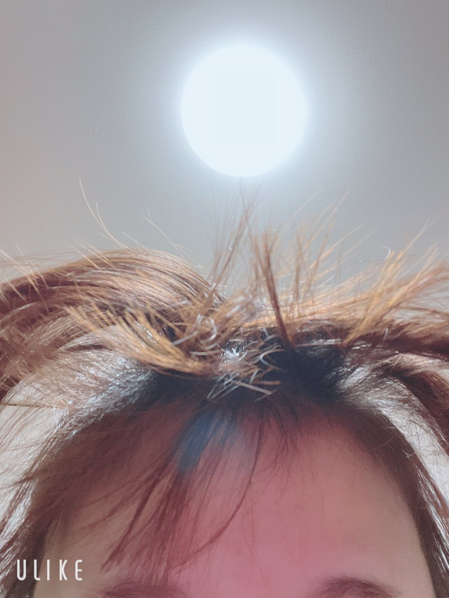 寝起き毎回前髪爆発するのどうにかしたい