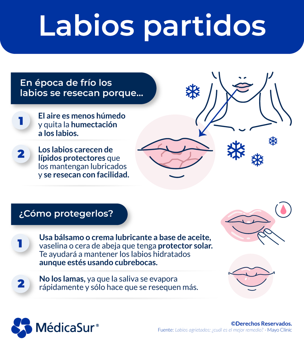 medicasur's tweet photo. ¿Labios resecos? El #frío es el principal causante de esa #deshidratación. ¡Conoce más y protégelos!
#Labios #Sequedad #LabiosPartidos #Piel #Dermatólogo #Invierno https://t.co/yKX9pWu2XN