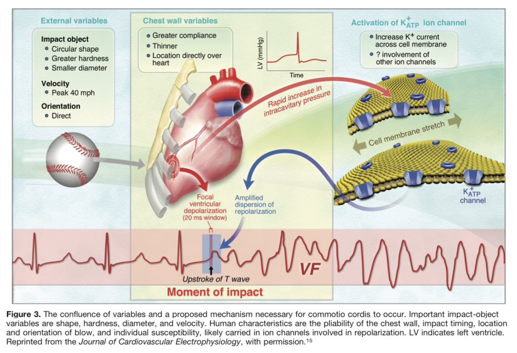 edgarvlermamd's tweet photo. Commotio Cordis #IMPearls #PathophysiologyPearls

👉🏼 https://t.co/bA00MLoo1u https://t.co/3KhROgHjYY