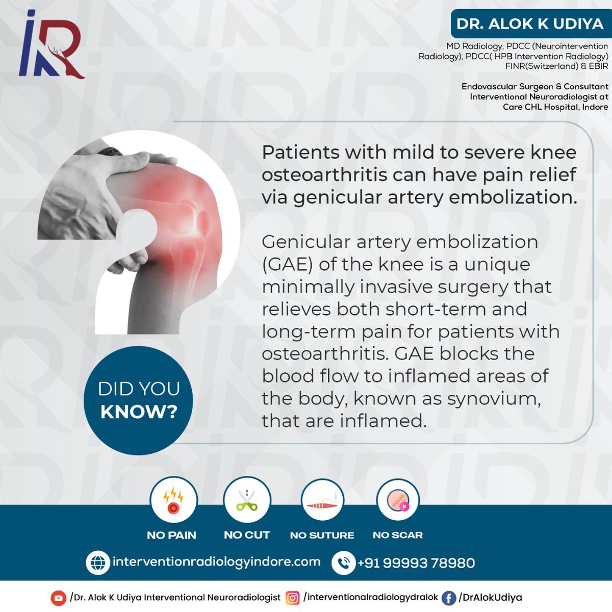 If you want relief from knee pain, then Book your appointment Dr. Alok K Udiya
#geniculararteryembolization #kneearthritis #interventionalradiology #GAE  #nonsurgical #kneepaintreatment #osteoarthritis #arthritiskneepain #painmanagement #chronicpain #dralokkudiya #carechl