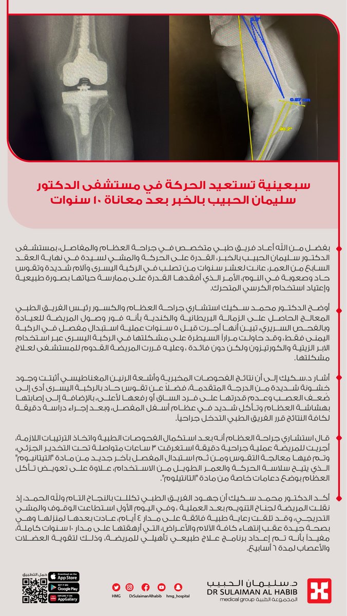 سبعينية تستعيد الحركة في مستشفى الدكتور سليمان الحبيب بالخبر بعد معاناة 10 سنوات
#مجموعة_د_سليمان_الحبيب_الطبية