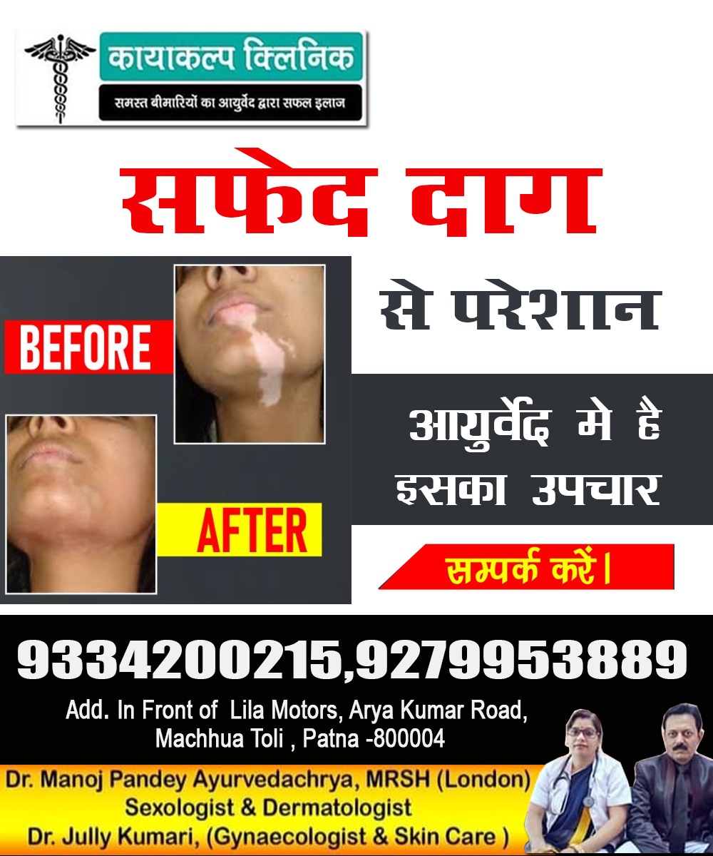 kayakalpclinic's tweet image. Kayakalp Clinic Patna doctors offer a safe and effective treatment for your Leukoderma ( Vitiligo ) problems by Ayurveda.
#Leucoderma #vitiligo #vitiligoawareness #vitiligobeauty #vitiligomodel #vitiligotreatment #skincare #skintreatment #skin #skincareproducts #skincareroutine