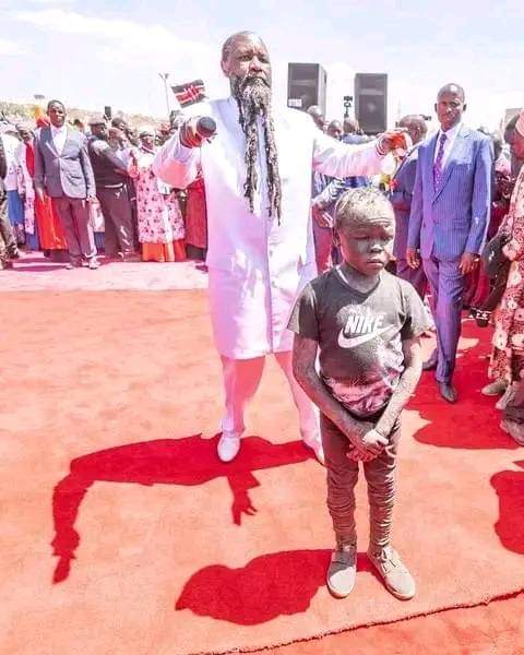 AchiiAguru's tweet photo. If God healed again leprosy what do you need to see ndio umwogope kweli for me I really fear him so much https://t.co/hpYxJARzXb