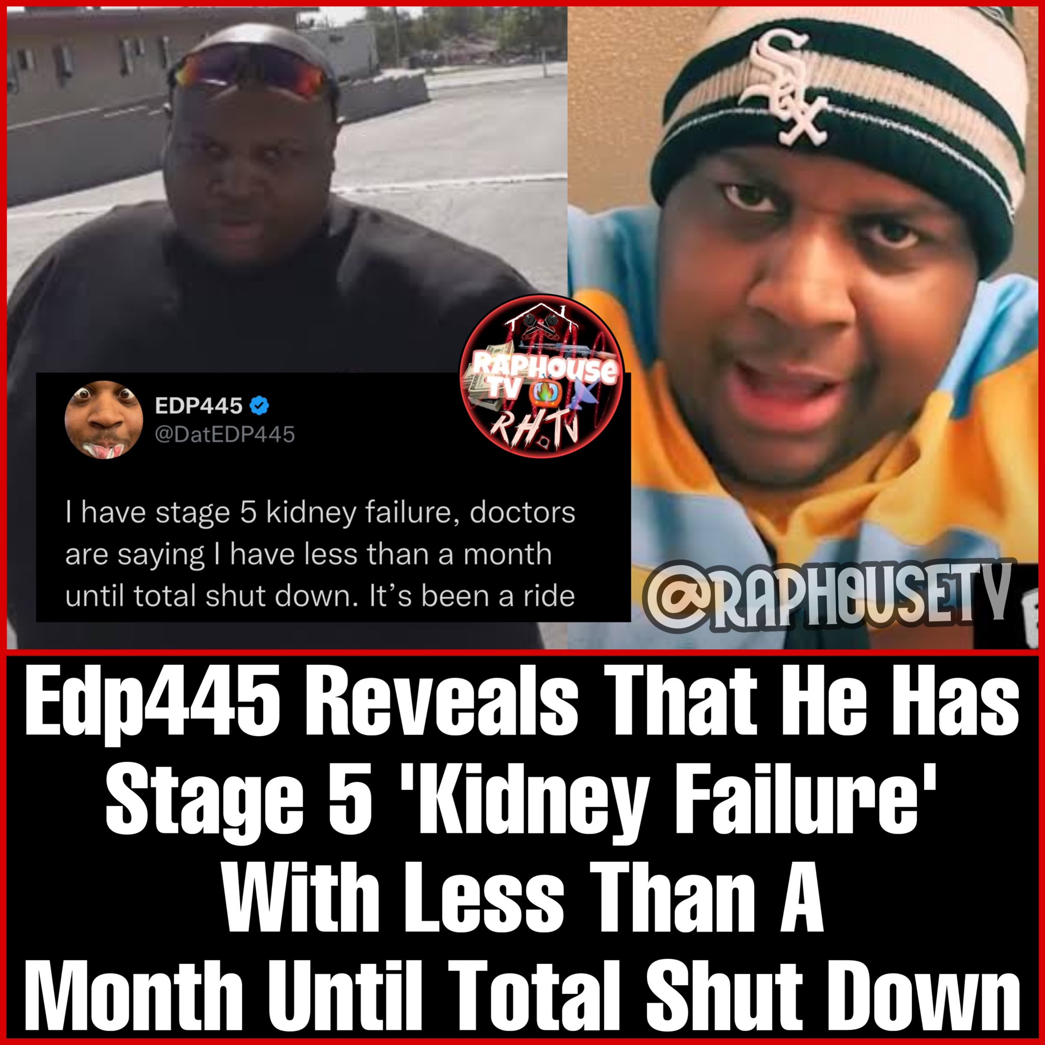 Illness: Is Edp445 Dying From Liver Failure? Reveal He Has Stage 5 Kidney Disease