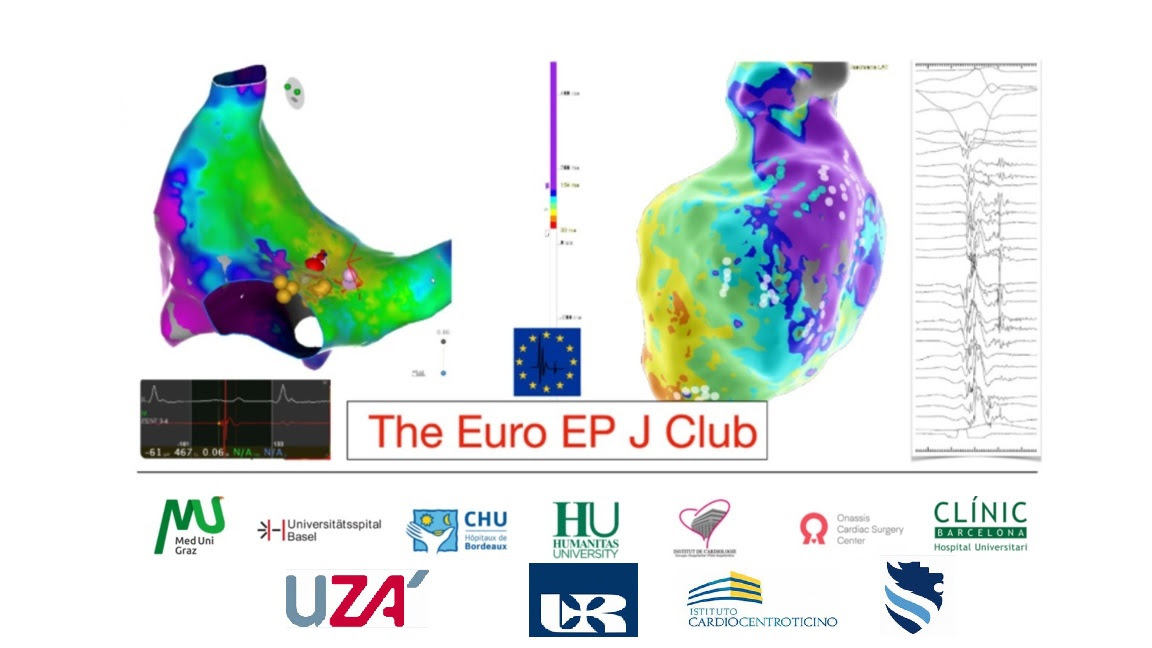 First❤️‍🔥EURO-EP JC❤️‍🔥of 2023 

⏰Today at 5:30 CET

🚨 Gaps after linear ablation of pers AF (Marshall-PLAN): Clinical implication by <a href="/Ciongo/">Ciro Ascione</a> 

Join us to get a deep dive into the study: tinyurl.com/yzy8ebc6

Full study in <a href="/hrs_journal/">HeartRhythm</a>
 
heartrhythmjournal.com/article/S1547-…