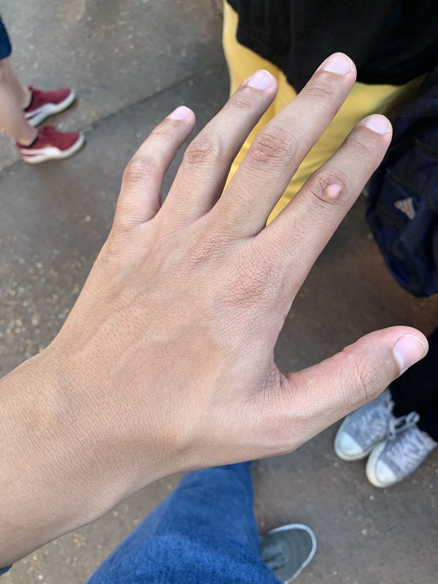 RaigekiVolpeVA's tweet photo. My veins be poppin today
#Irlpic #vtuber #envtuber https://t.co/aJNXP4SMrd