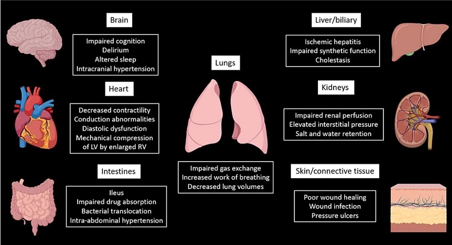 🎯Diagnóstico de la sobrecarga ☔️de líquidos💧💧💧💧: Desde  los conceptos convencionales🌊 a los contemporáneos
🗝🔓👇🏻👇🏻👇🏻👇🏻👇🏻
karger.com/Article/Pdf/52…
