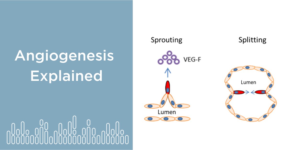 AraceliBio's tweet image. Microscopy, high throughput automation, and image analysis are critical steps in angiogenesis research, which plays a role in over 50 disease processes. 

Check out our educational article to know more! aracelibio.com/articles/angio…
#angiogenesis #endothelialcells #sprouting #splitting