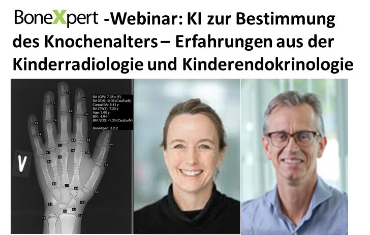 BoneXpert's tweet photo. BoneXpert for autonomous bone age assessments. German experience with BoneXpert in pediatric radiology and pediatric endocrinology. Join our webinar on 1 February 2023: https://t.co/8aexrMrqEh
#boneage #knochenalter #radiology #radiologie #endokrinologie https://t.co/X4kb2ZtVpA