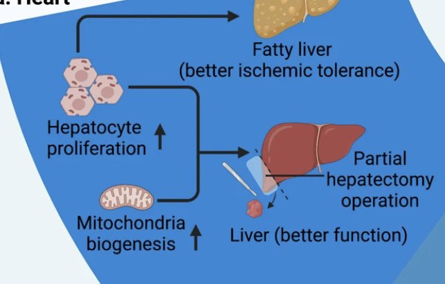 Benefits of #exercise (6/7)

Physical activity 🏊‍♀️ promotes regeneration ability of fatty liver, ⬆️ its tolerance to ischemia. 🏃🏿can restore #liver function by ⬆️  hepatocyte proliferation and mitochondrial biosynthesis in patients with partial hepatectomy. nature.com/articles/s4139…