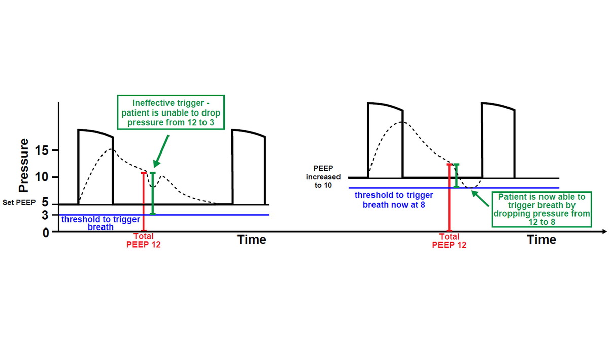 ATS Scholar tweet media