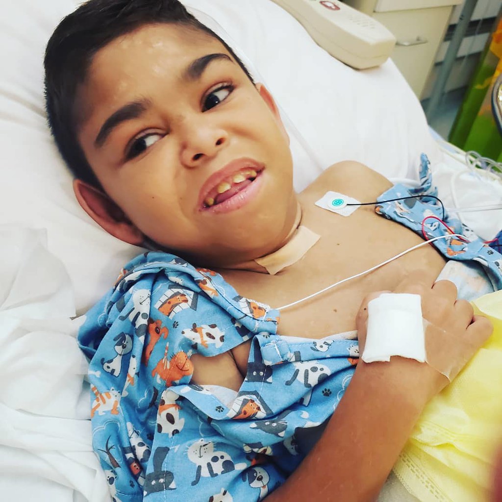 LLUChildrens's tweet photo. Aiden Reynolds, 11, has been our patient since birth. He was born with Eagle-Barrett syndrome, a disorder characterized by poor development or lack of muscles in the abdomen and urinary tract.

Read Aiden’s story at the link in bio https://t.co/TfHacGXzNv https://t.co/MV9hb109b0