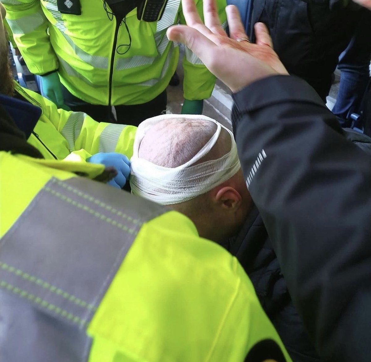 Football Away Days on Twitter "Celtic fans requiring medical attention