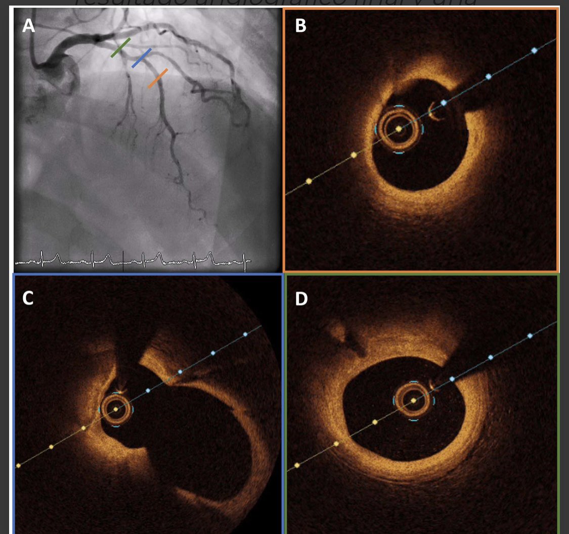 We already have the solution of the case. Check it out at foroepic.org What’s you opinion of #DCB in the context of #CTO ?
