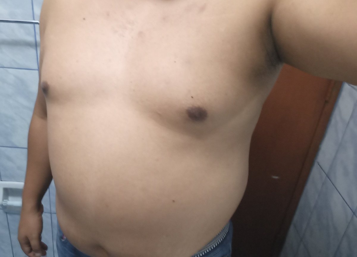 alfrepasdiscre's tweet photo. Hace calor jeje https://t.co/1BVrDnIzCC