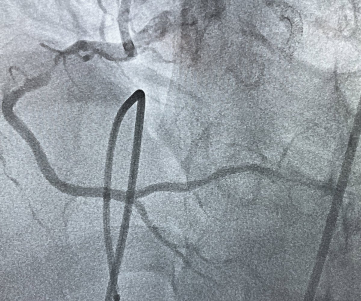 Joseph Yang tweet media