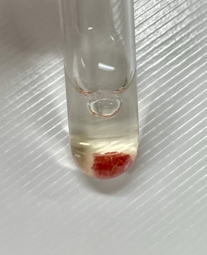 NidheeshDadhich's tweet photo. First SC-Islet prep of the year 2023. These beautiful islets has gifted us a kickstart of the month👌. We just transplanted🩼 these into bunch of mice🐁. Can’t wait to see how they function in next 6 months. #SCIslet #BetaCells #Diabetes #iPSC https://t.co/w8cFDBrvDK
