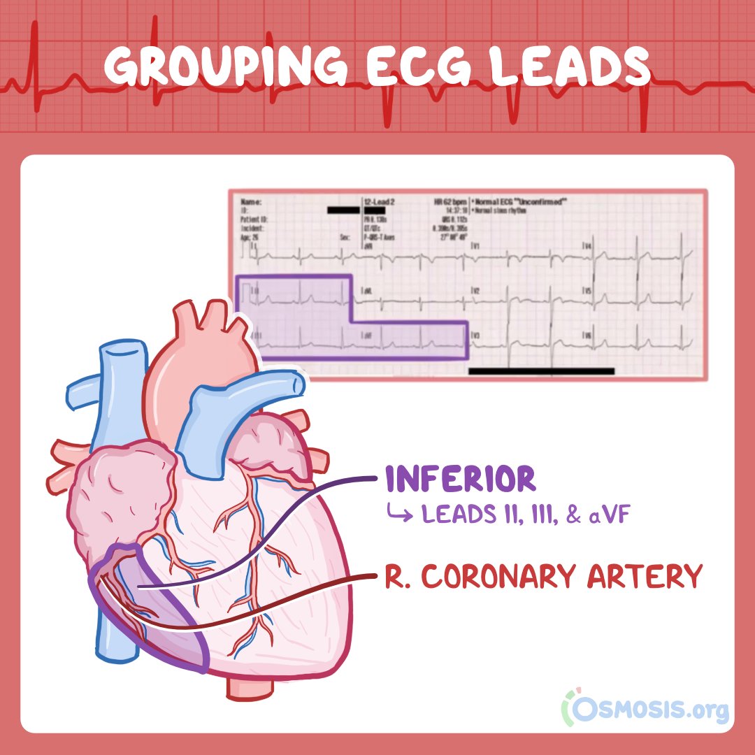 Osmosis Prime ECG Series Osmosis edu.svet.gob.gt