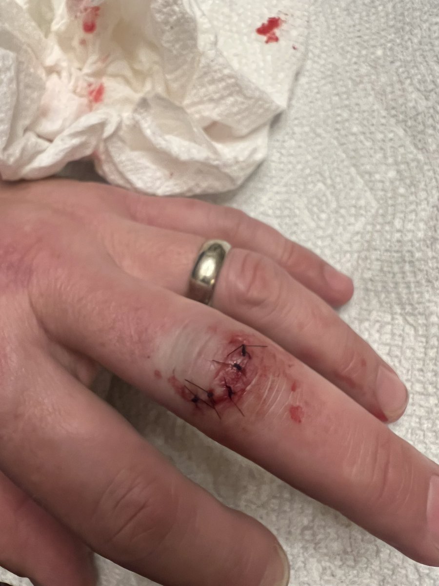 Sam Brewster tweet media