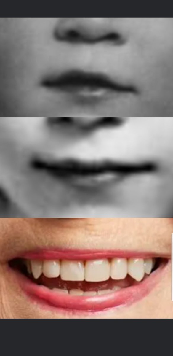 lost_heir's tweet photo. EVER NOTICE IN MOST PICS THE QUEEN ALWAYS HIDES HER LEFT SIDE OF HER FACE..PLASTIC SURGERY,DUE TO CLEFT PALATE,FATHER AND MOTHER ARE REALLY BROTHER AND SISTER.HARD TO SEE.LEFT LIP IS SMALLER THEN HER RIGHT
#QUEEN #ANASTASIA #UK #IRELAND #SCOTLAND #WELSH #ENGLAND #LONDON https://t.co/NrYss9yRaH