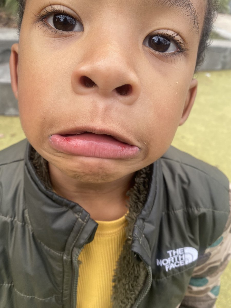 QueensDlight's tweet image. Somebody help us shoot a skate part.