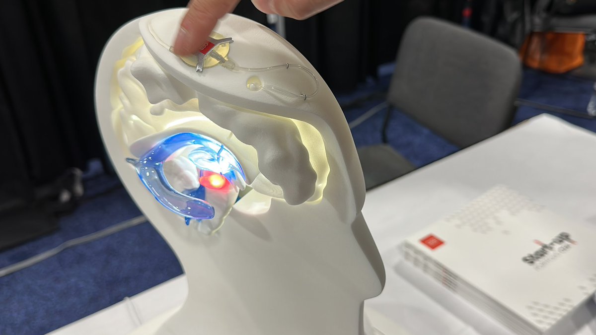 JeromeColombain's tweet image. Il n’y a pas que Neuralink qui fait des implants cérébraux… La startup Clinatec émanation du @CEA_Officiel expérimente un traitement contre la maladie de Parkinson par la lumière via une fibre optique insérée dans le cerveau 😯