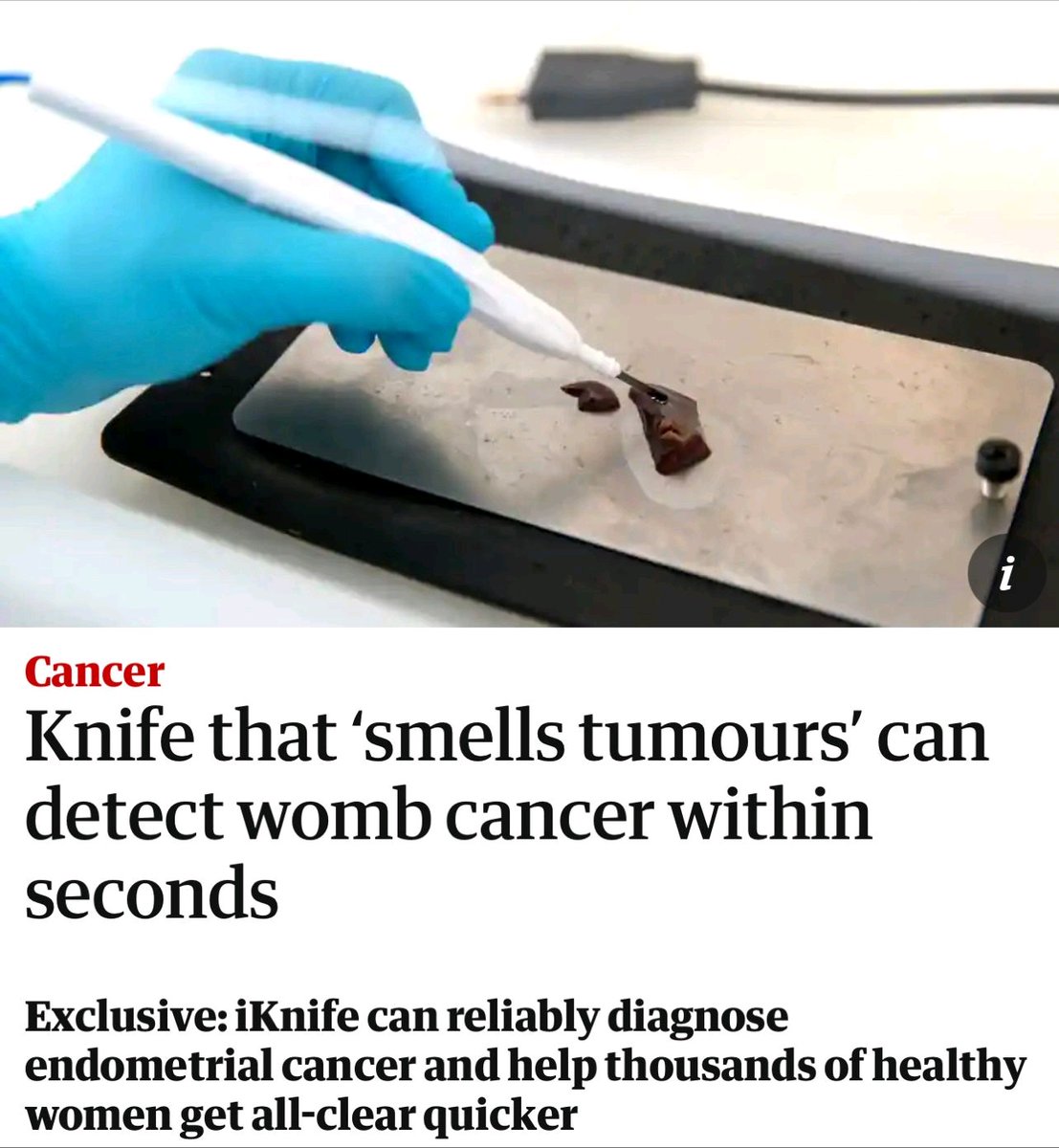 A revolutionary surgical knife discovered that sniffs tumors & diagonises #wombcancer at the wink of an eye! This discovery will enable women getting all clear quickly. Thanks to reseacher.