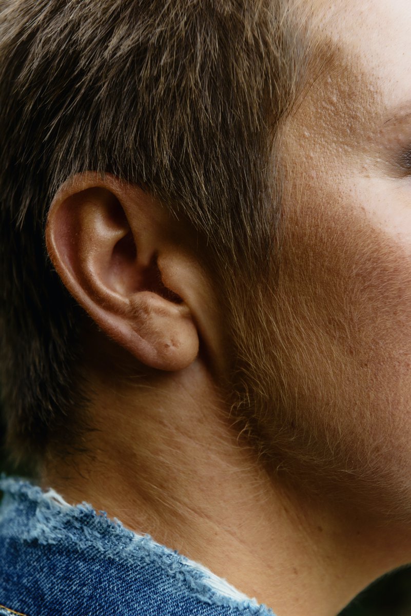 OxfordstreetTC's tweet photo. Ear wax removal service is available every Monday morning here at OSTC. Book your appointment here:
https://t.co/PmRJ5EjmpQ
Or call us on 01933 224454
#earwaxremoval #earwax #microsuction #hearingloss #blockedears #earclinic #ear #blockedear #earmicrosuction #earwaxextraction https://t.co/bTfT6ZX4Aw