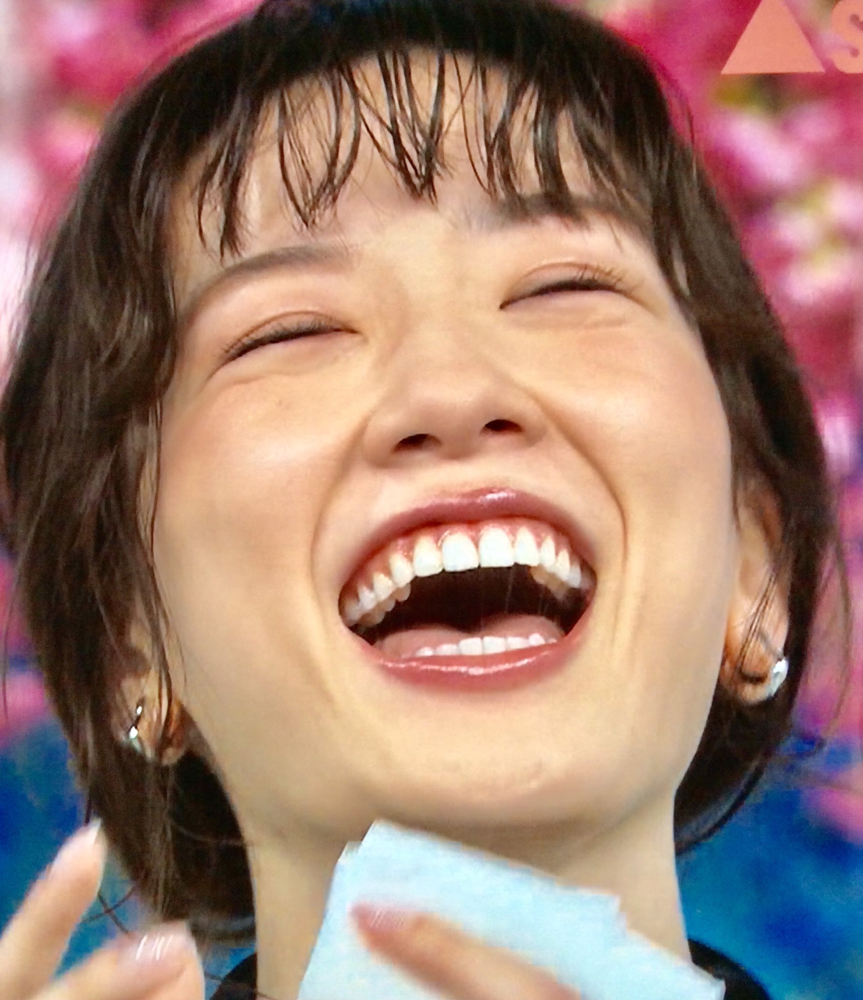 女性芸能人銀歯画像 