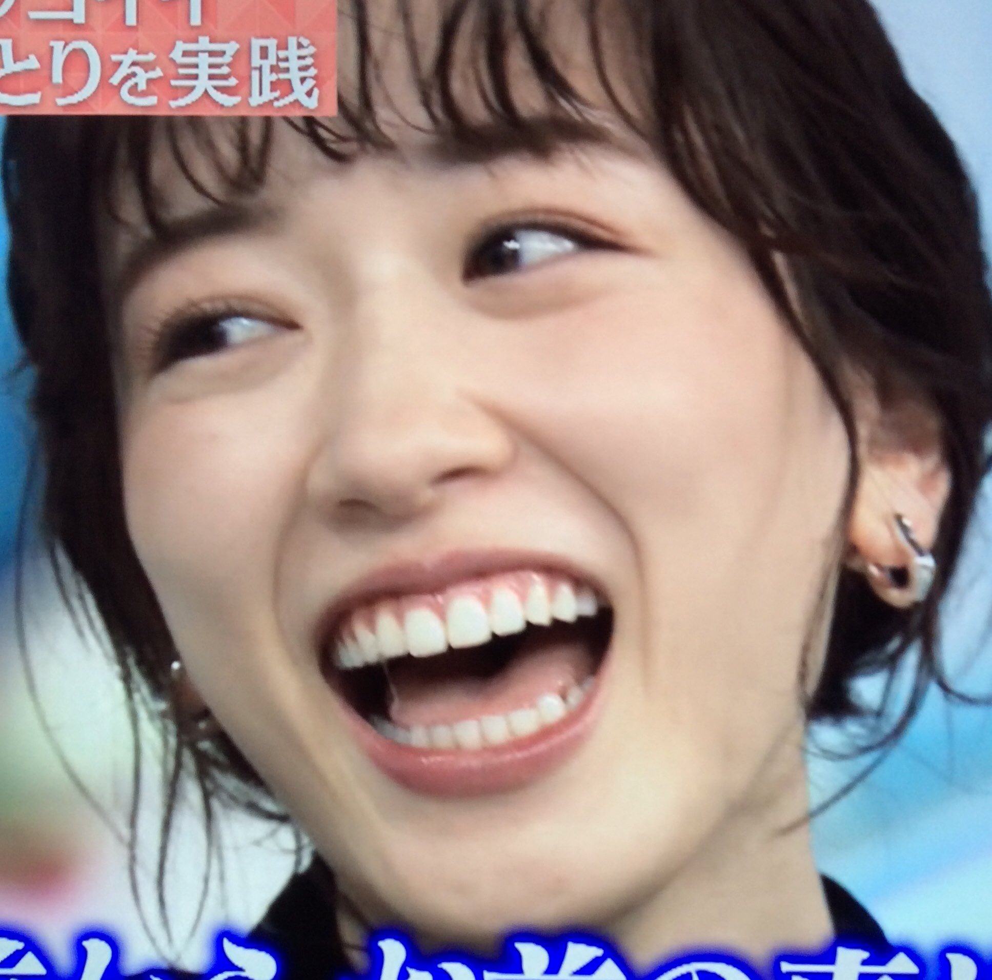 女性芸能人銀歯画像 