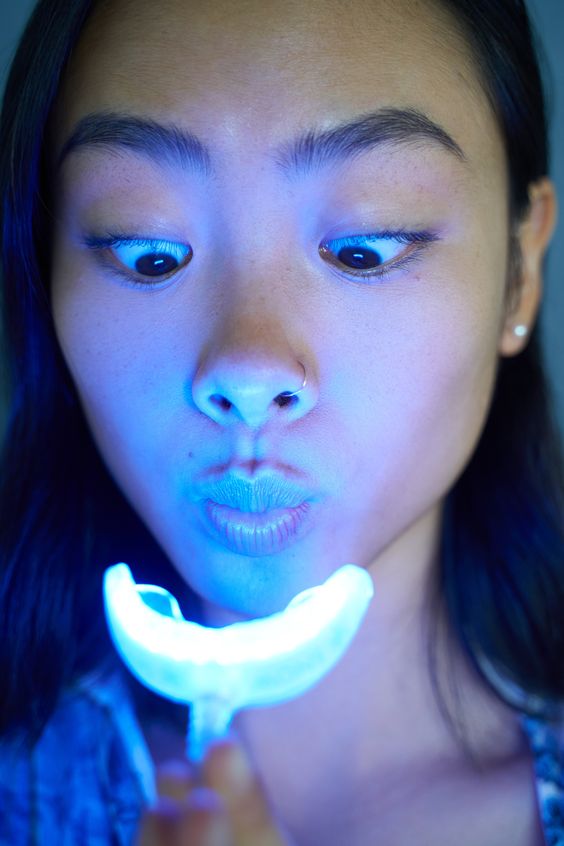 Who doesn’t love bright, white teeth? 🤩🤍#teethwhitening #whiteteeth #pearlywhites #snowwhiteningkit #fyp