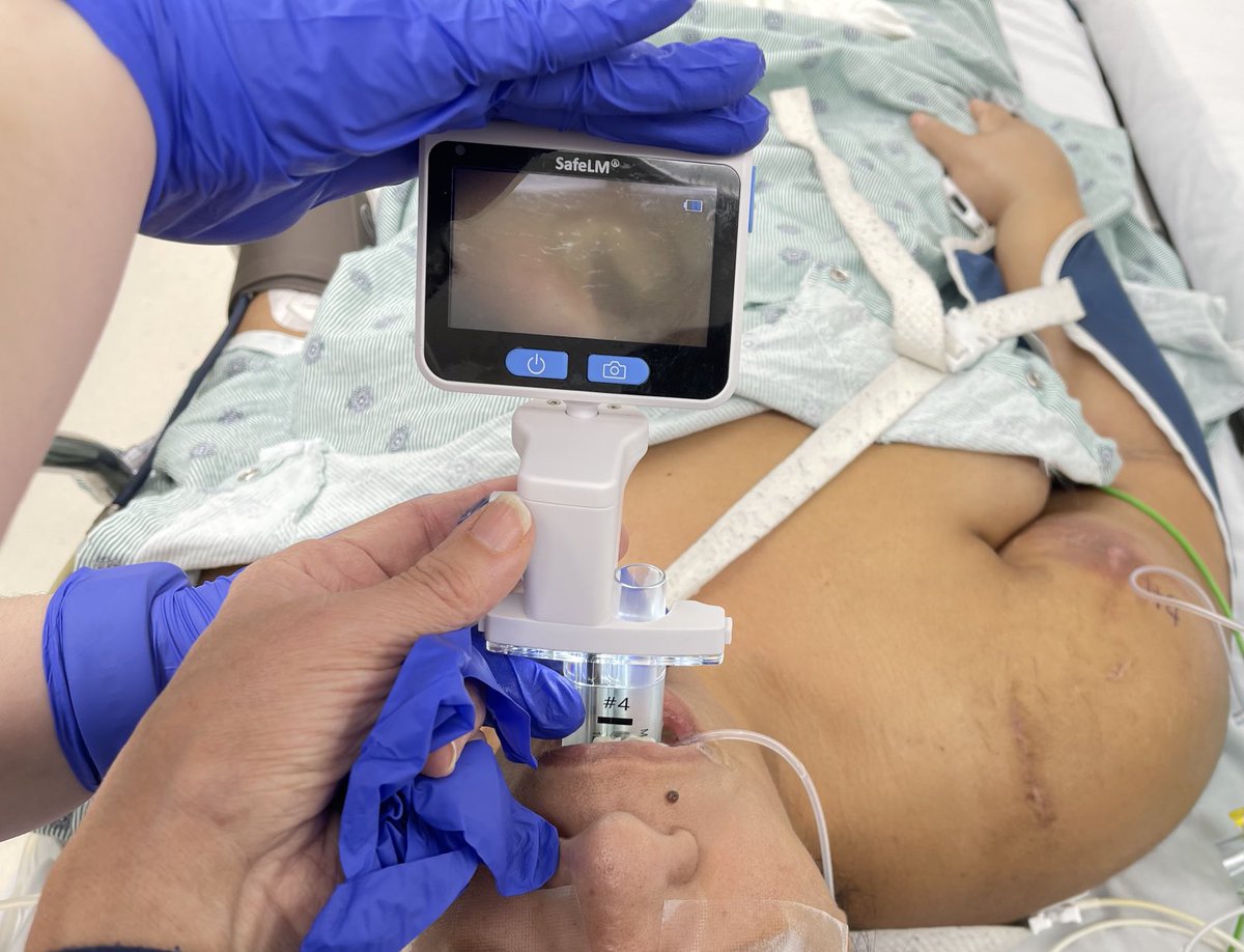 Irene Osborn/ Airway goddess tweet media