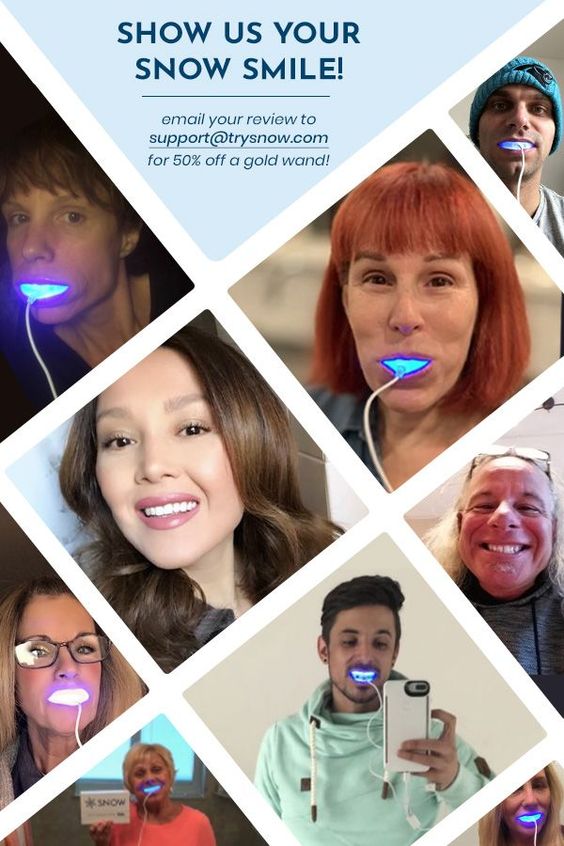 ❄️Snow® At-Home Teeth Whitening Kit | Results Guaranteed Celebrity Owned ❄️ #smile #whiteningkit #teeth #happy