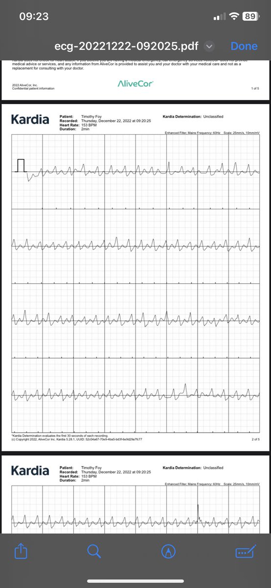 runfoyrun's tweet photo. @MKIttlesonMD Is this abnormal? https://t.co/9jBnfgrEcK