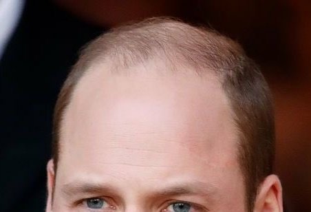 unrealpathan's tweet photo. @PopBase "difficult, rude, and abrasive" maybe bro was just talking to his own hairline in the mirror and Harry heard him wrong https://t.co/QAwQZEvCJL