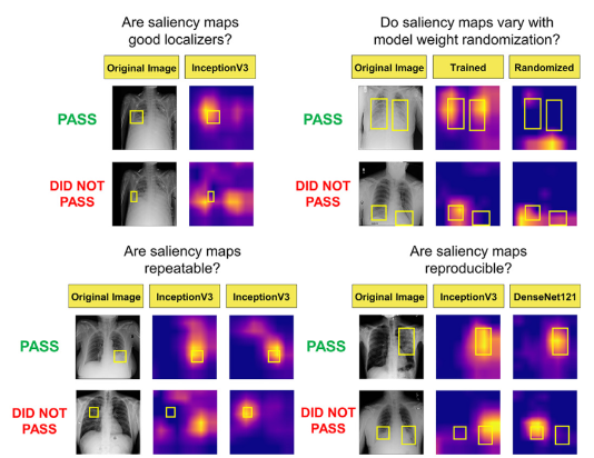 T1 Saliency maps are used to mitigate the “black-box” nature of AI algorithms. Arun et al. highlight a major limitation of the saliency map technique, including limited repeatability/reproducibility on localization, segmentation and detection tasks in medical imaging. #RadAIChat