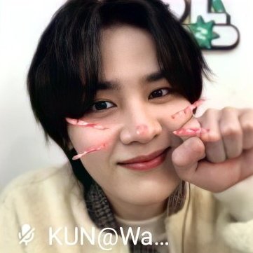 picsforkun's tweet photo. my meow meow 🐾 https://t.co/aijvzZ2BYJ