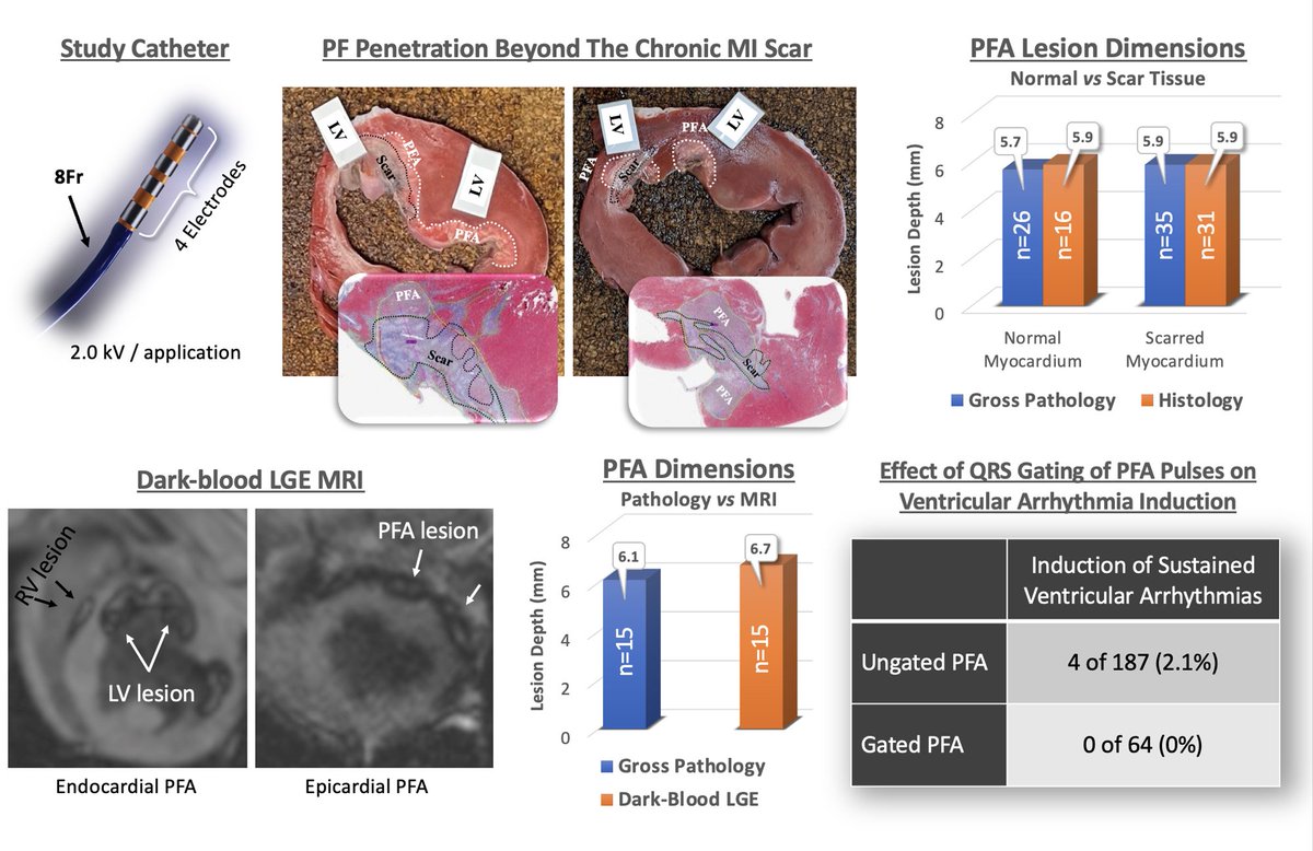 Jacob Koruth (@jskoruth) on Twitter photo Electrophysiology, Pathology, and Imaging of Pulsed Field Ablation of Scarred and Healthy Ventricles in Swine- authored by our super fellow <a href="/iwanari65284818/">Iwanari Kawamura</a> -- out in Circ EP Electrophysiology, Pathology, and Imaging of Pulsed Field Ablation of Scarred and Healthy Ventricles in Swine- authored by our super fellow <a href="/iwanari65284818/">Iwanari Kawamura</a> -- out in Circ EP